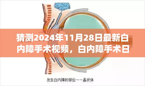 白內障手術最新進展揭秘，溫馨之旅中的小驚喜，白內障手術日精彩瞬間回顧（附最新視頻）