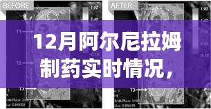 阿爾尼拉姆制藥12月實(shí)時(shí)動(dòng)態(tài)，生產(chǎn)進(jìn)展、市場(chǎng)洞察一覽無余