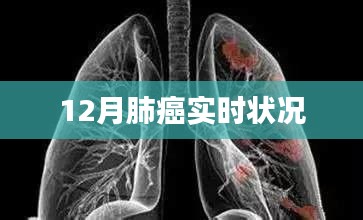 肺癌最新實時狀況，了解與預(yù)防